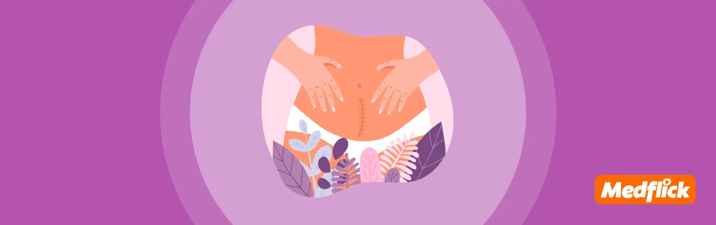 Navigating the Tummy Tuck Journey: Before, During, & After Treatment