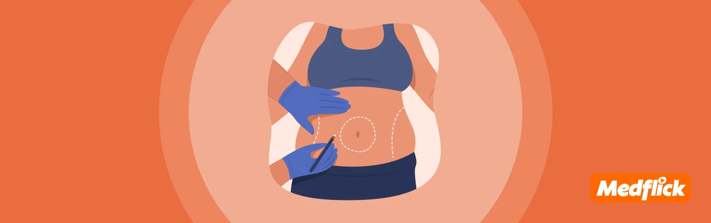 Liposuction: What to Expect Before, During, & After surgery